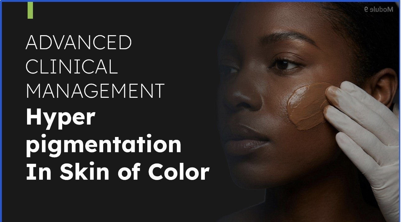 Management of Hyperpigmentation course preview